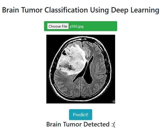 Brain Tumor detection App